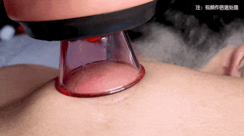 6 (2).gif